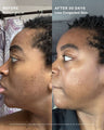 Clear Skin Mineral Milk 2% Salicylic Acid Acne Treatment with Niacinamide + Copper