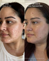 Clear Skin Mineral Milk 2% Salicylic Acid Acne Treatment with Niacinamide + Copper