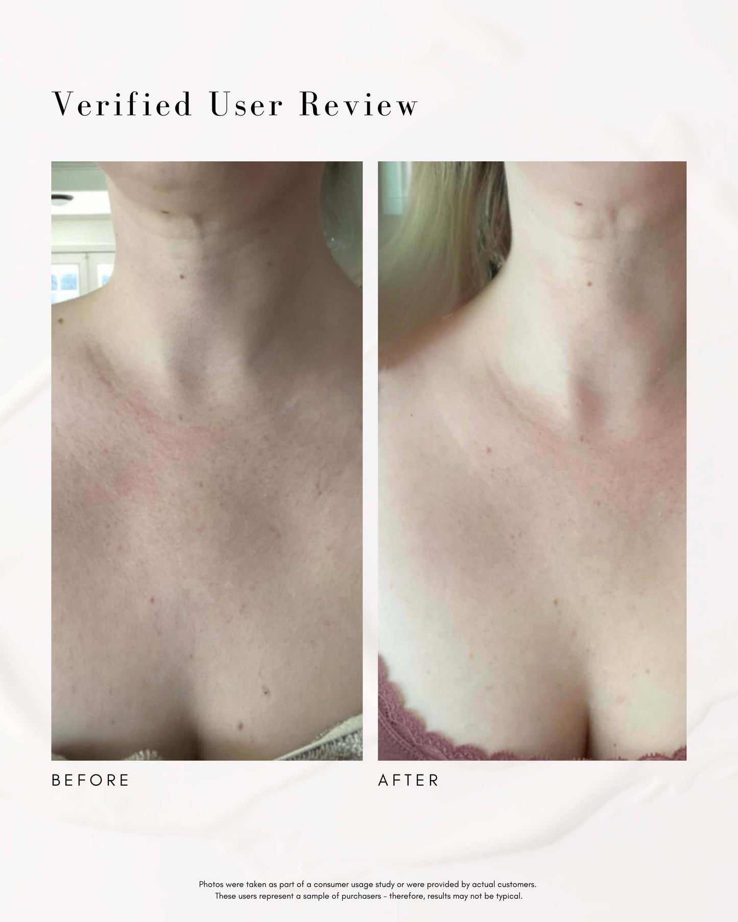 The Advanced Response Complex Face | Neck Cream