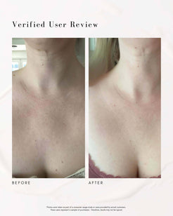 The Advanced Response Complex Face | Neck Cream