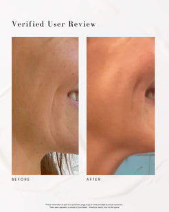 The Advanced Response Complex Face | Neck Cream