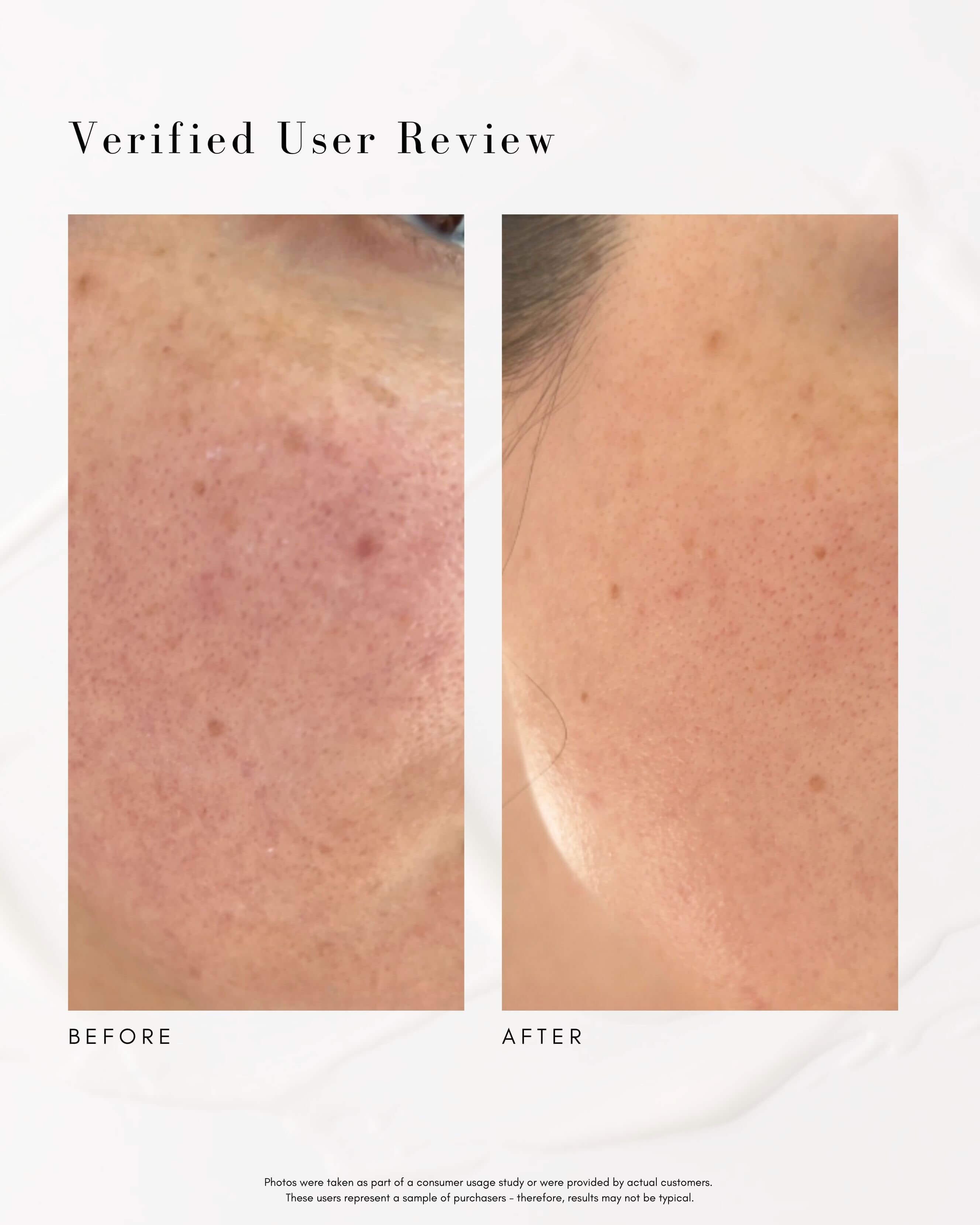 The Advanced Response Complex Face | Neck Cream