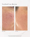 The Advanced Response Complex Face | Neck Cream