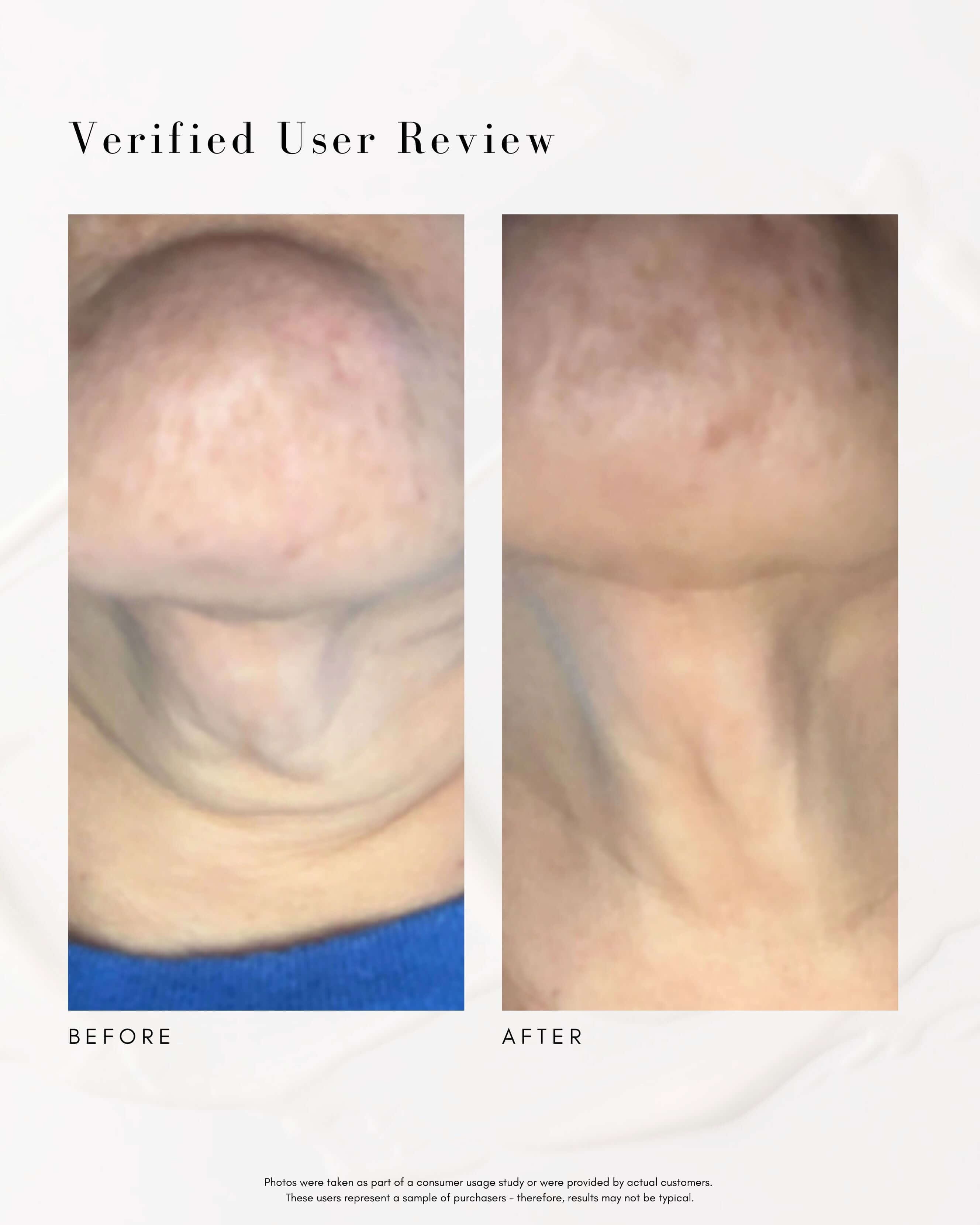 The Advanced Response Complex Face | Neck Cream