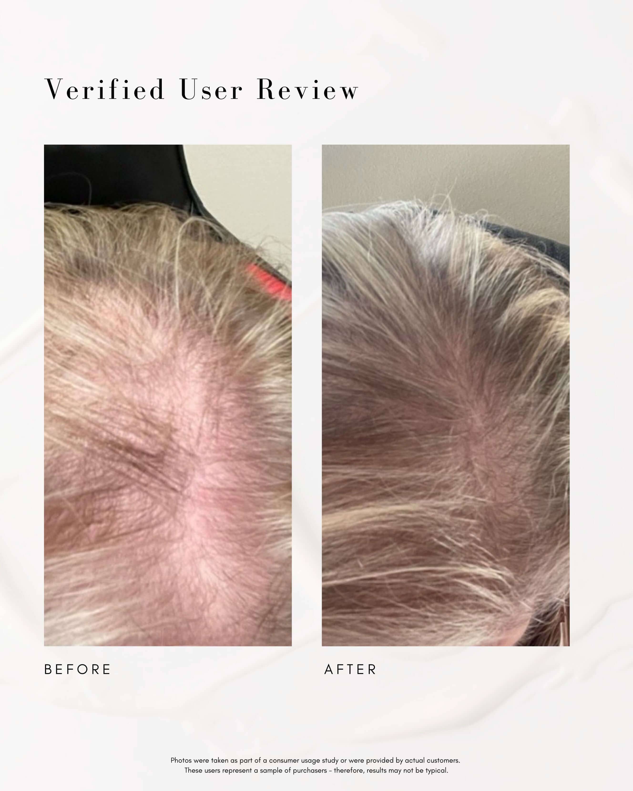 Power Fol Multi-Correctional Scalp and Hair Treatment