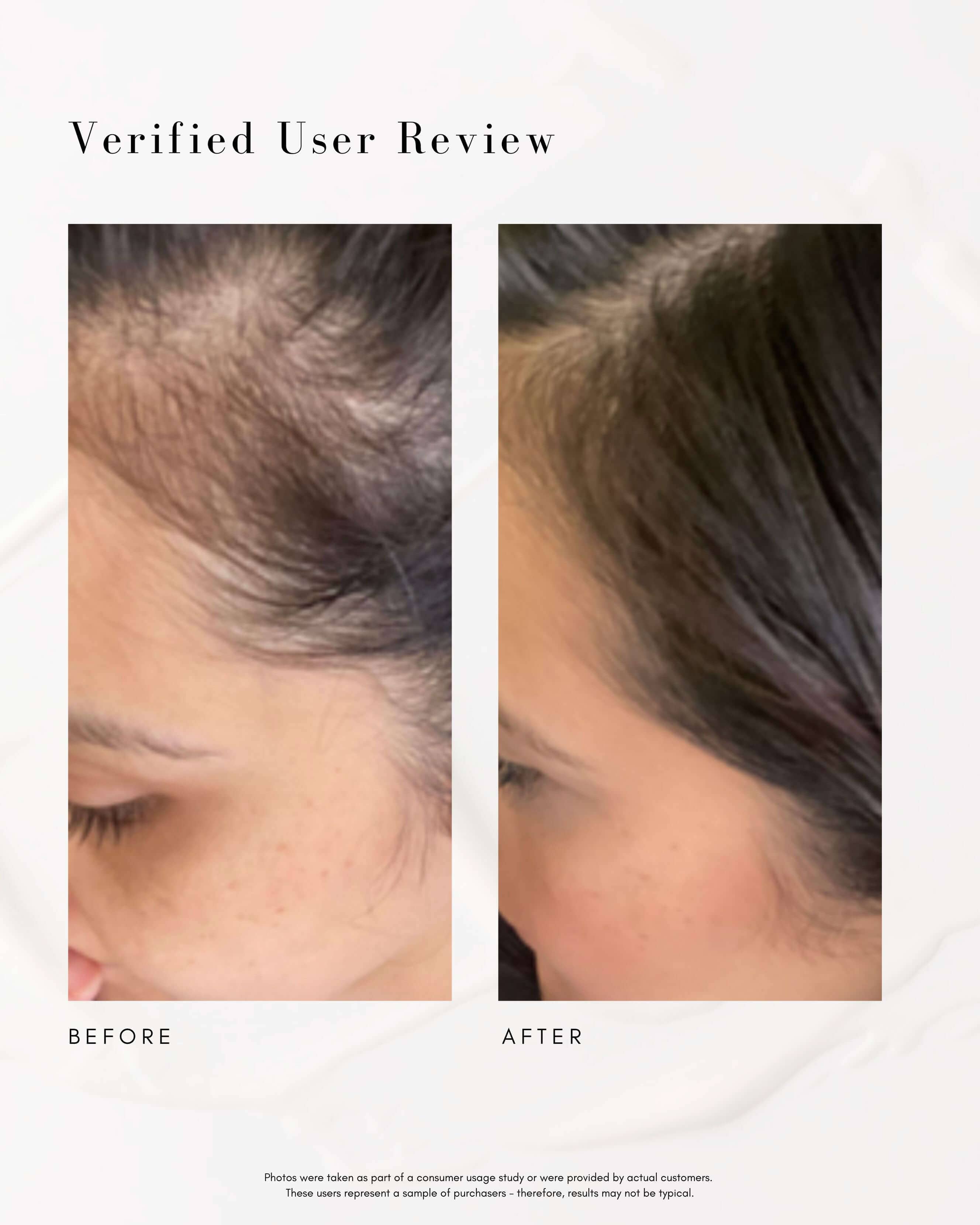 Power Fol Multi-Correctional Scalp and Hair Treatment