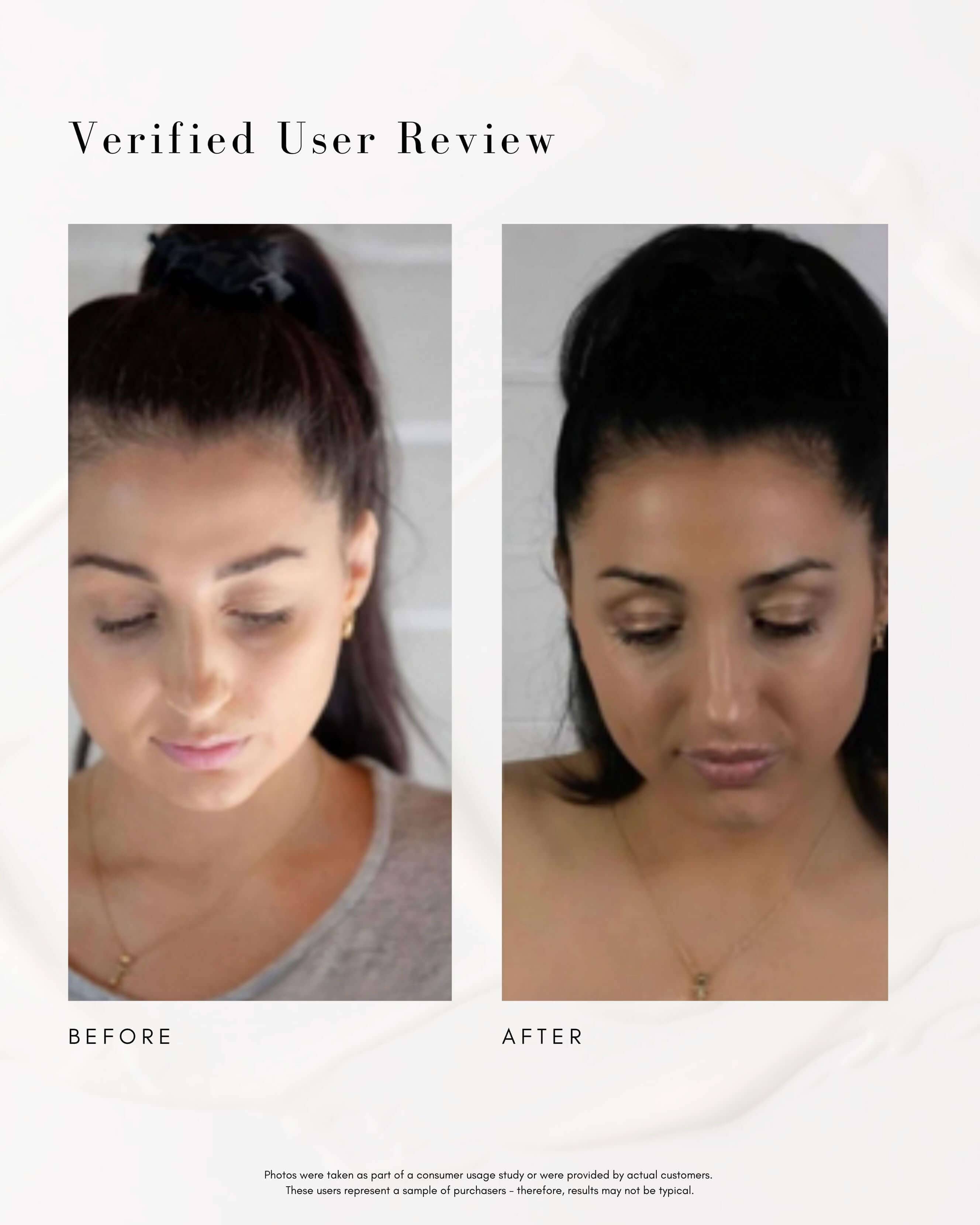 Power Fol Multi-Correctional Scalp and Hair Treatment