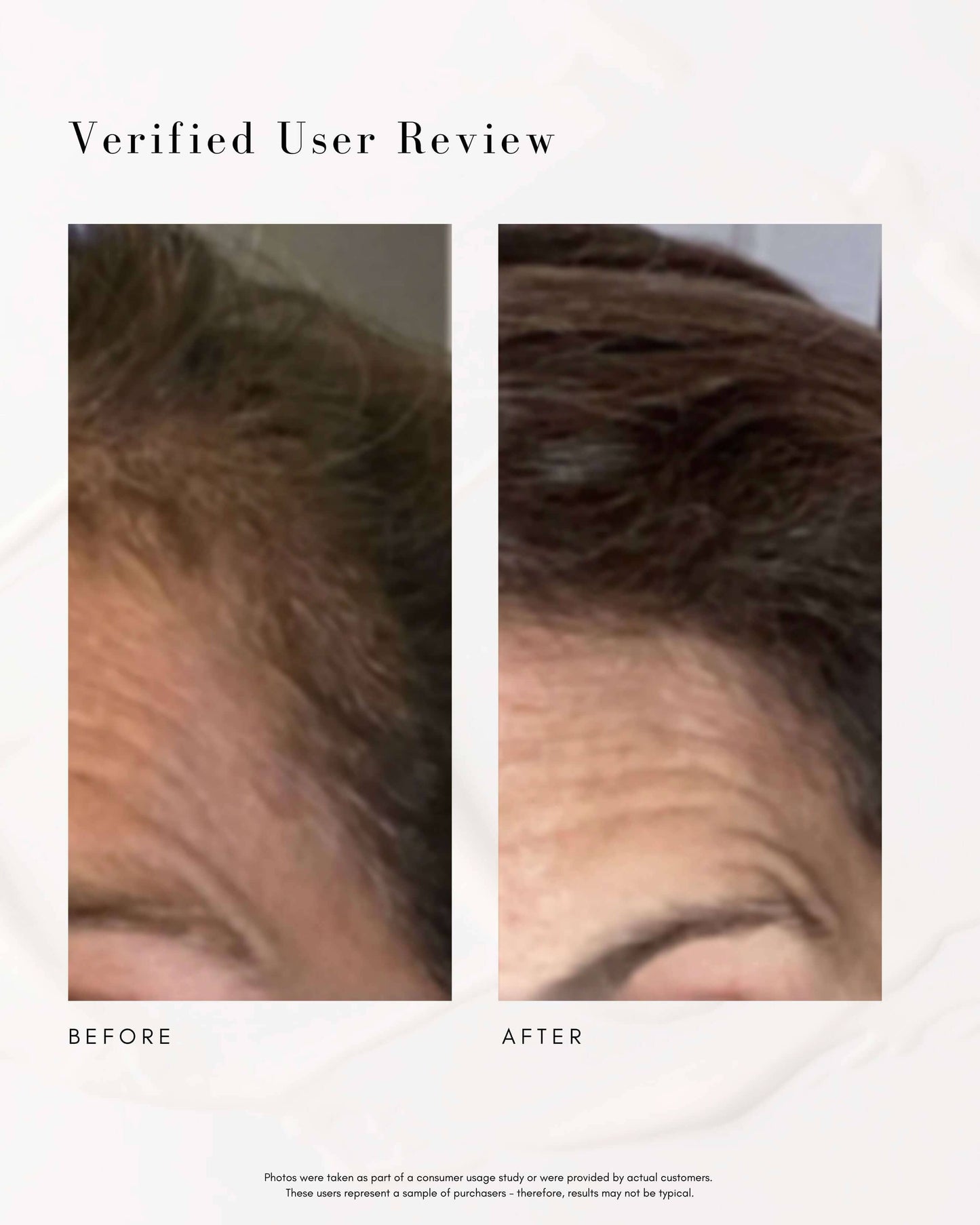 Power Fol Multi-Correctional Scalp and Hair Treatment