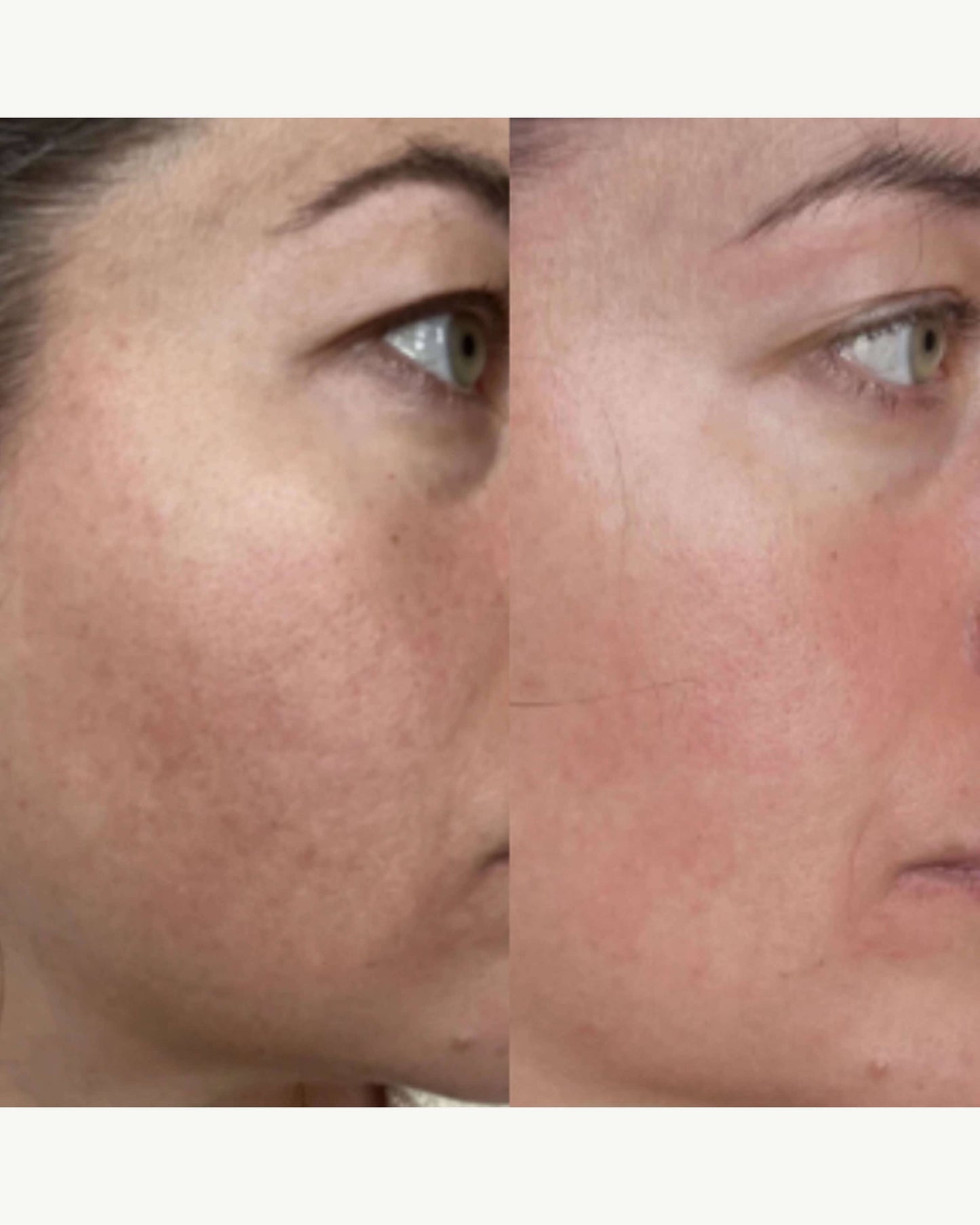 The Meringue Melt Regenerating Skin-Softening Cleanser