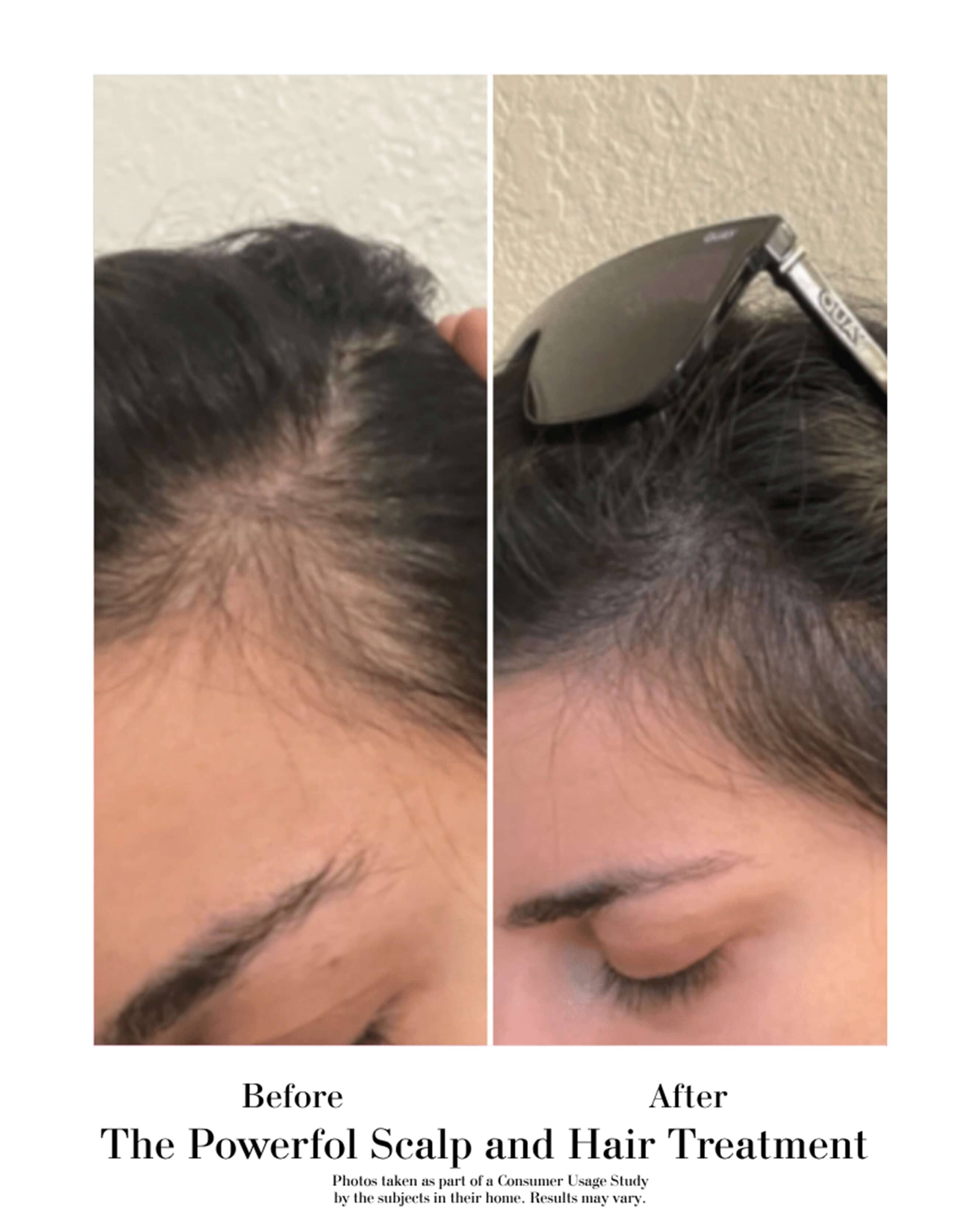 The Power Fol™ Root to Tip