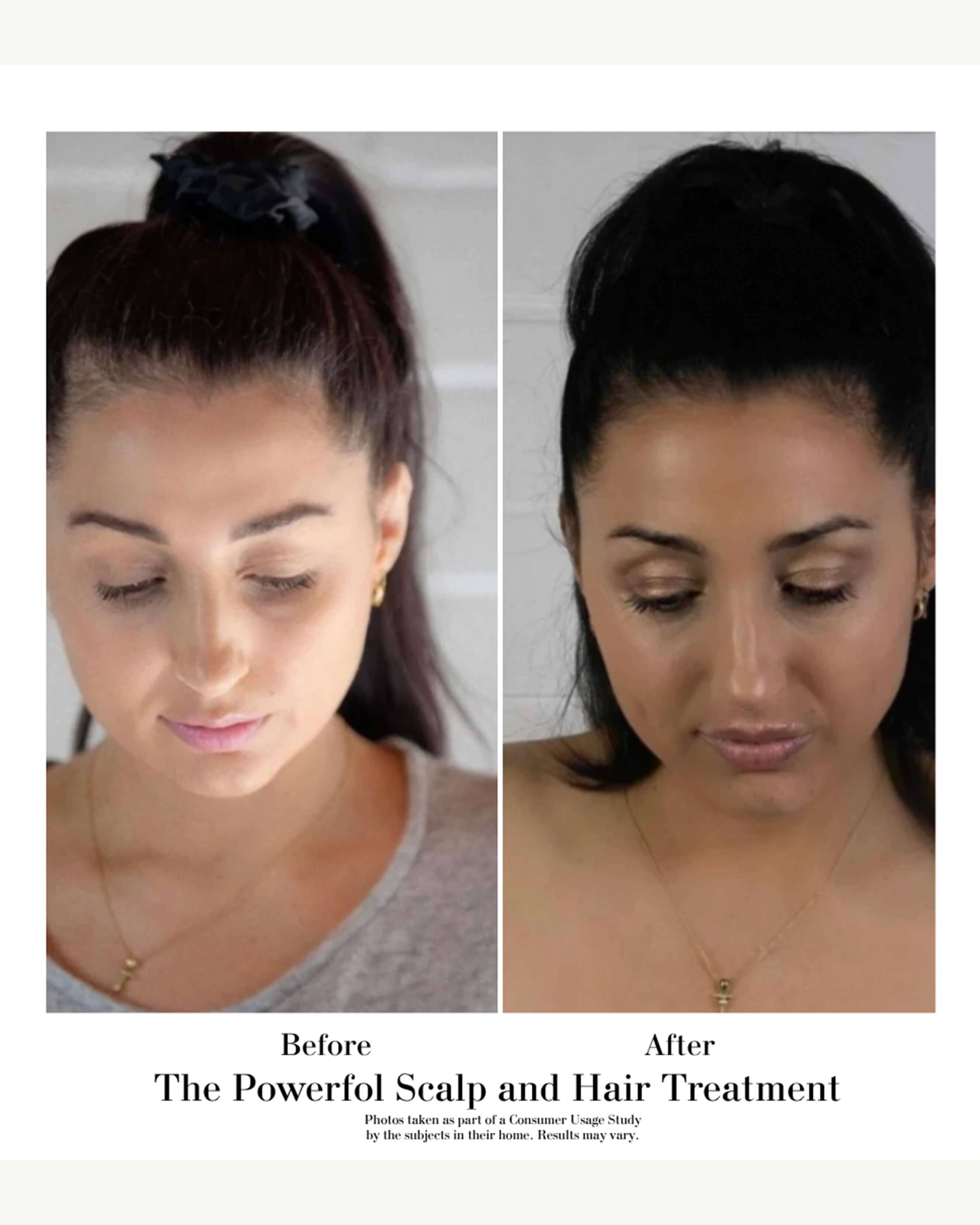 The Power Fol™ Root to Tip