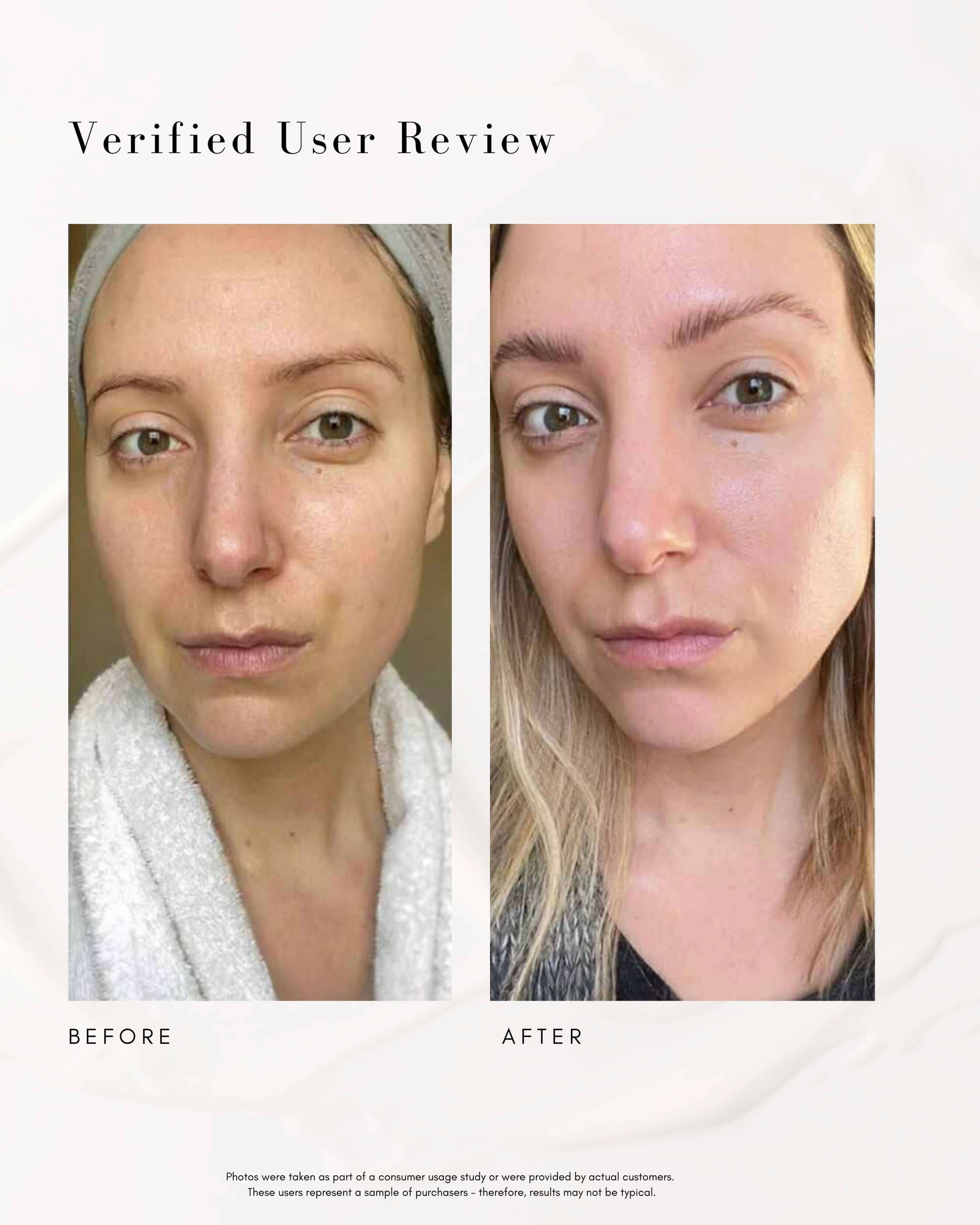 The Straight A Advanced Gentle Retinol Serum