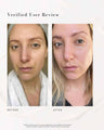 The Straight A Advanced Gentle Retinol Serum