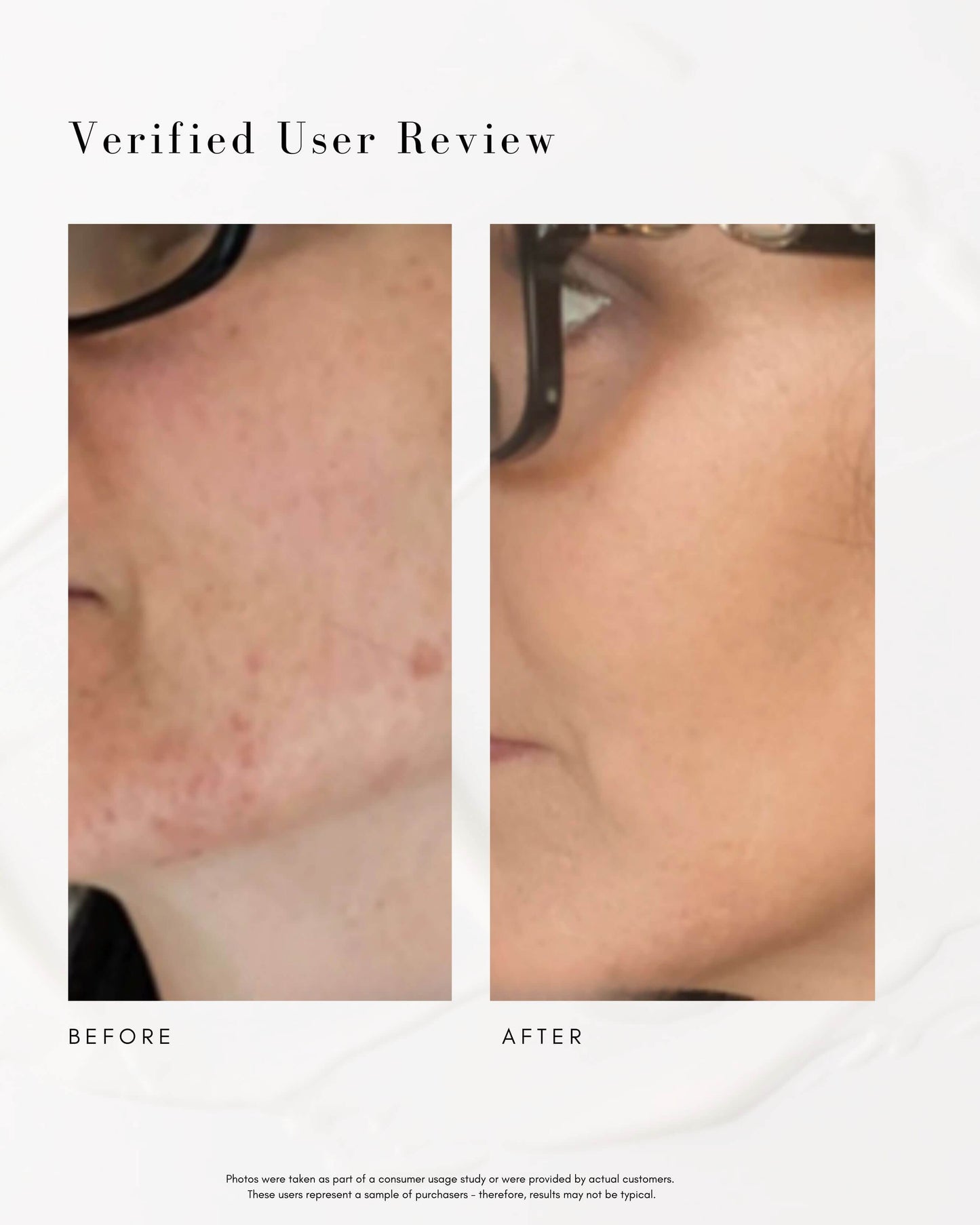 The Straight A Advanced Gentle Retinol Serum