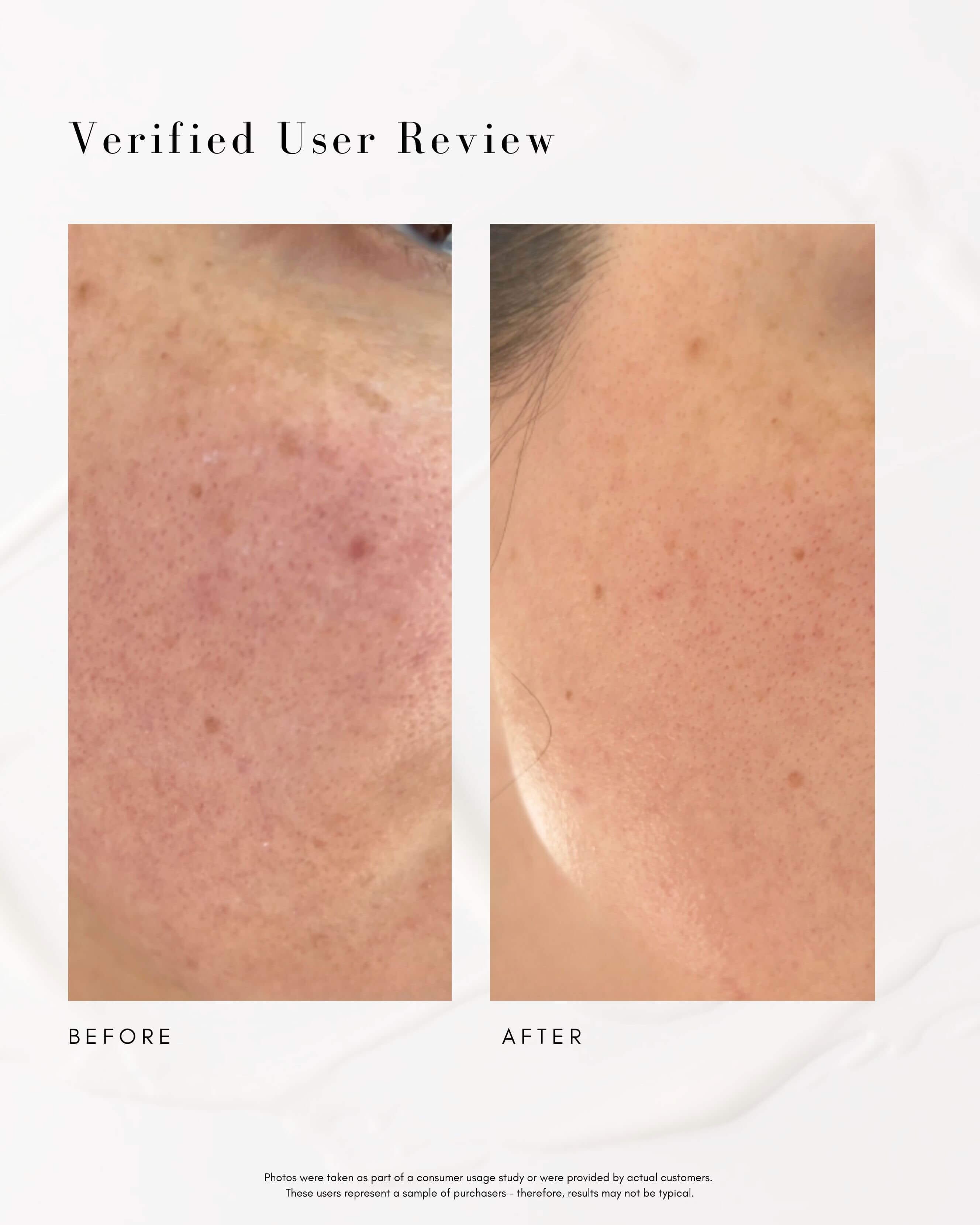 The Super Lift Vitamin C-More Treatment