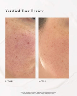 The Super Lift Vitamin C-More Treatment