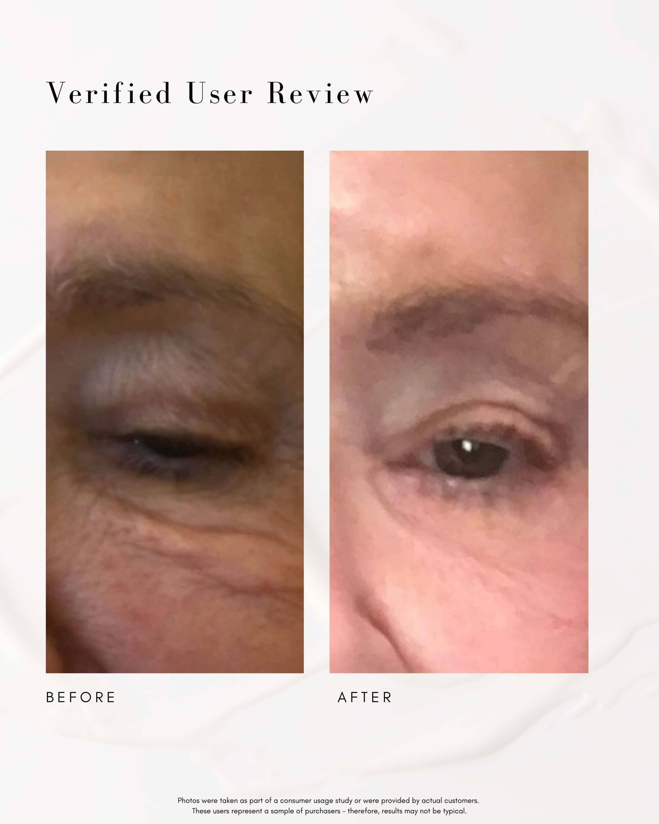 The Super Lift Vitamin C-More Treatment