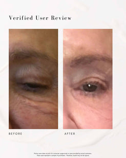 The Super Lift Vitamin C-More Treatment