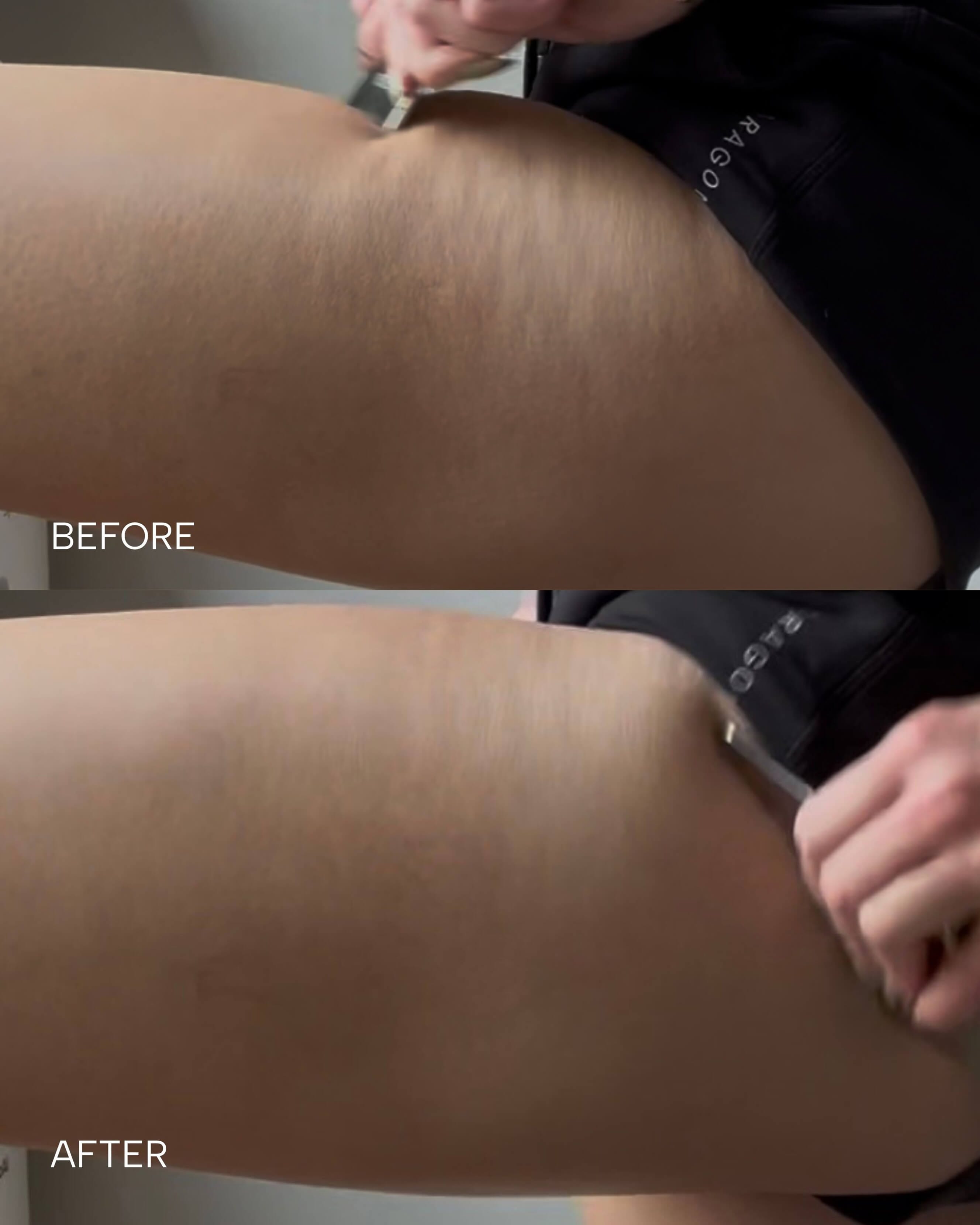 The Vitality Qi Stainless Steel Body Sculpt & Release Tool