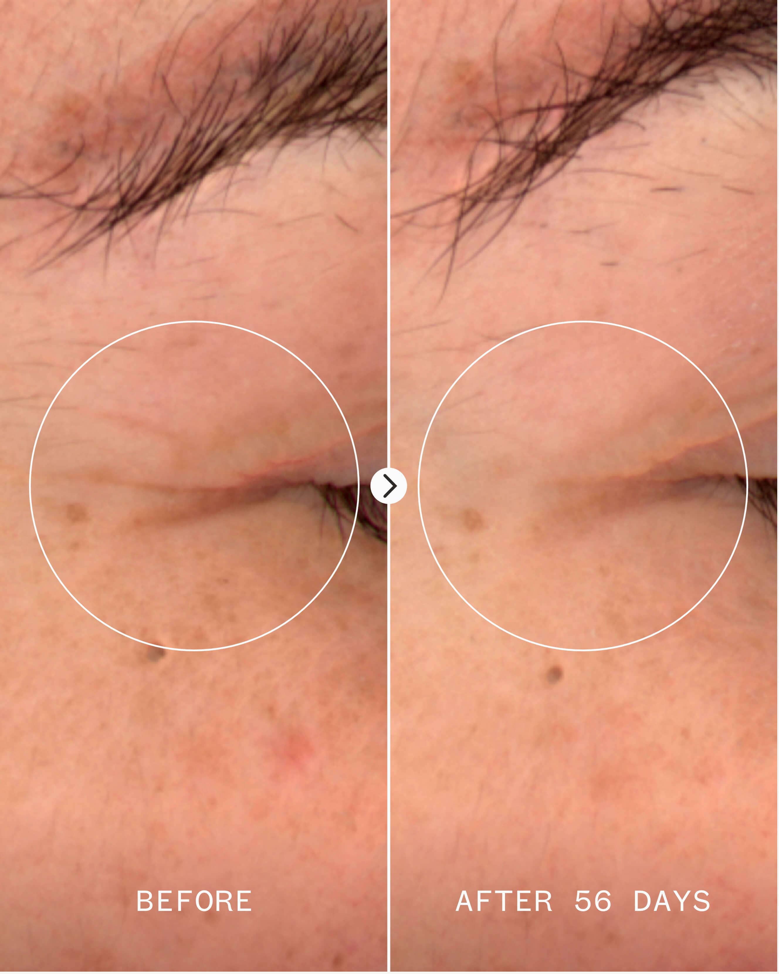 Age Confidence NAD+ & Tri-peptide Serum