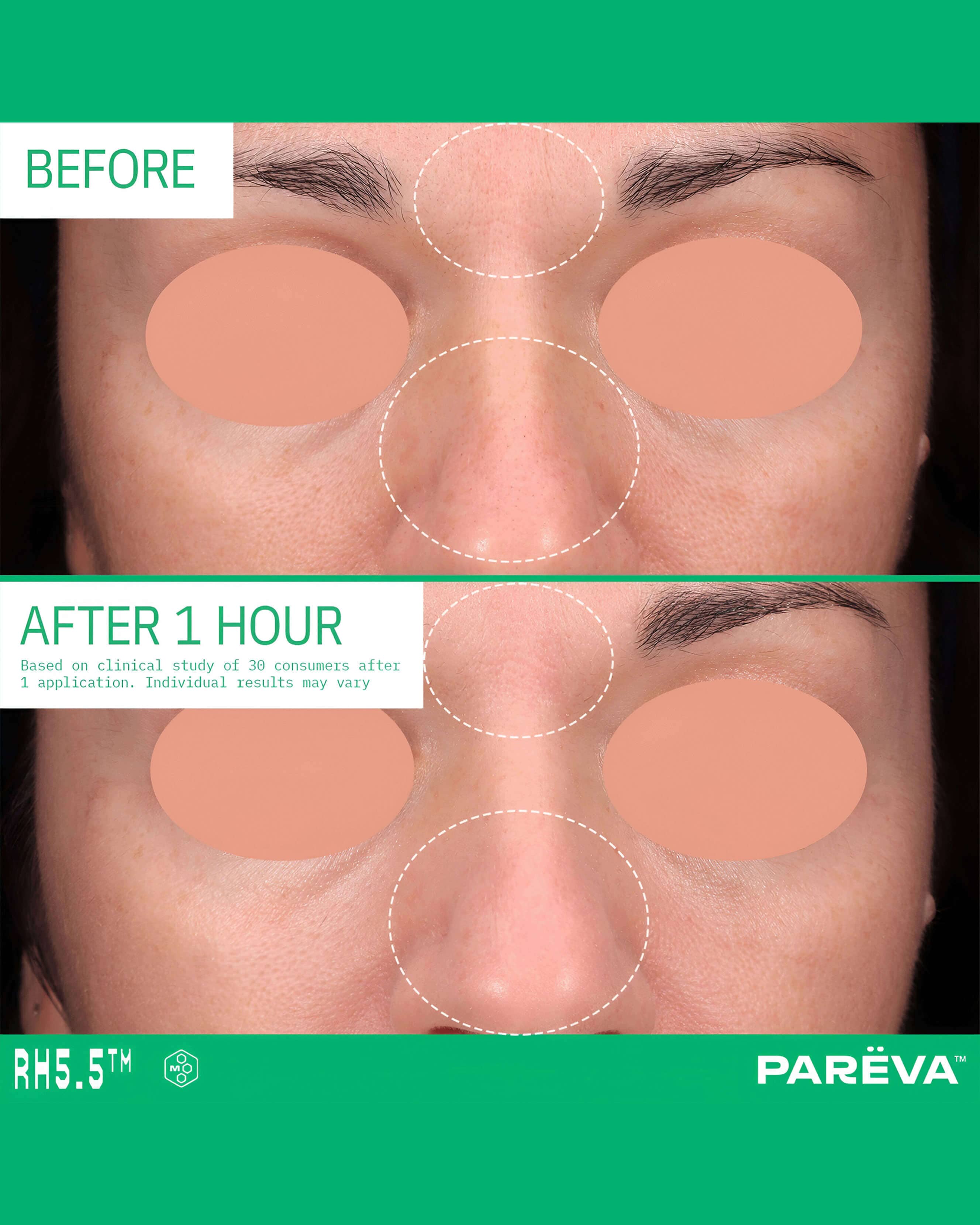 RH5.5 Hydrabond Primer