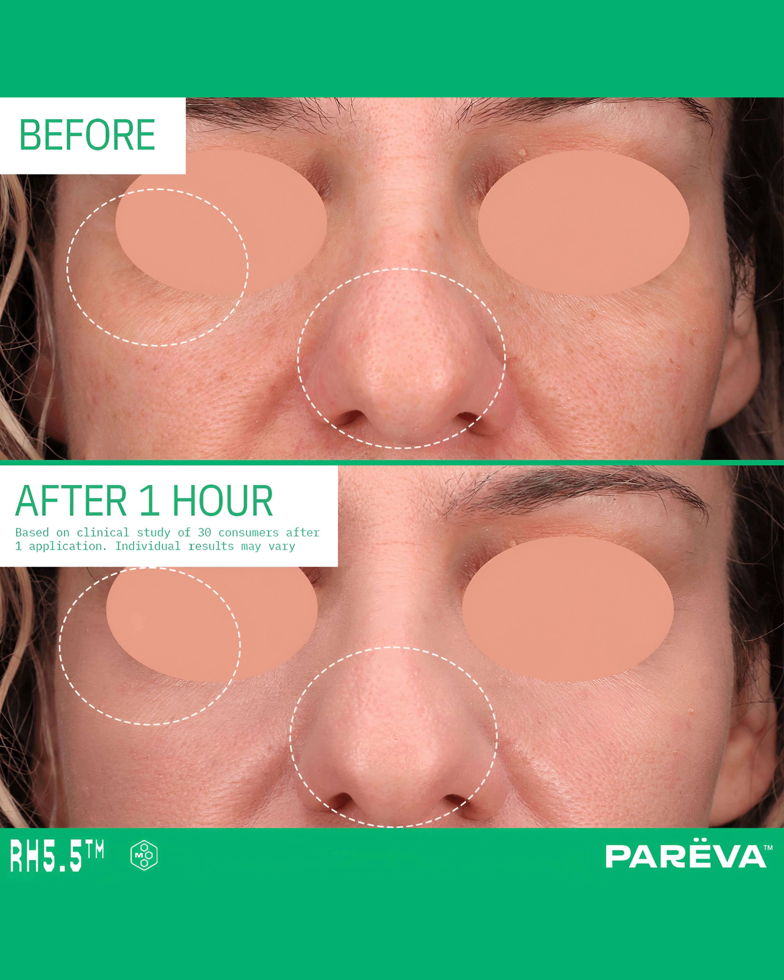 RH5.5 Hydrabond Primer