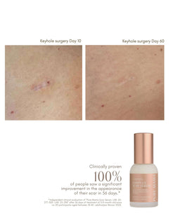 Complex Scar Serum