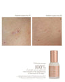 Complex Scar Serum