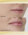 Lipnights Overnight Lip Mask