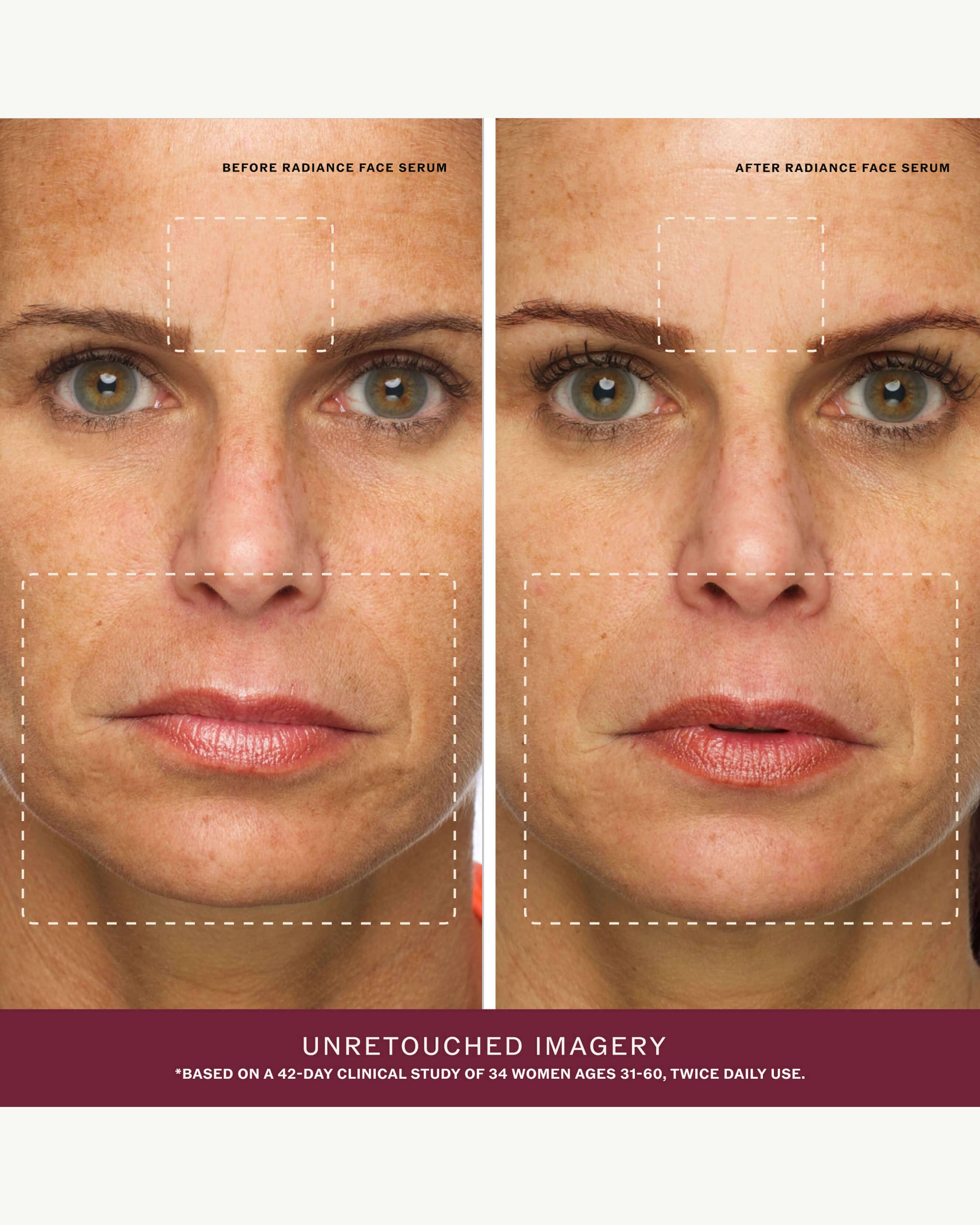 The Radiance Ritual Set