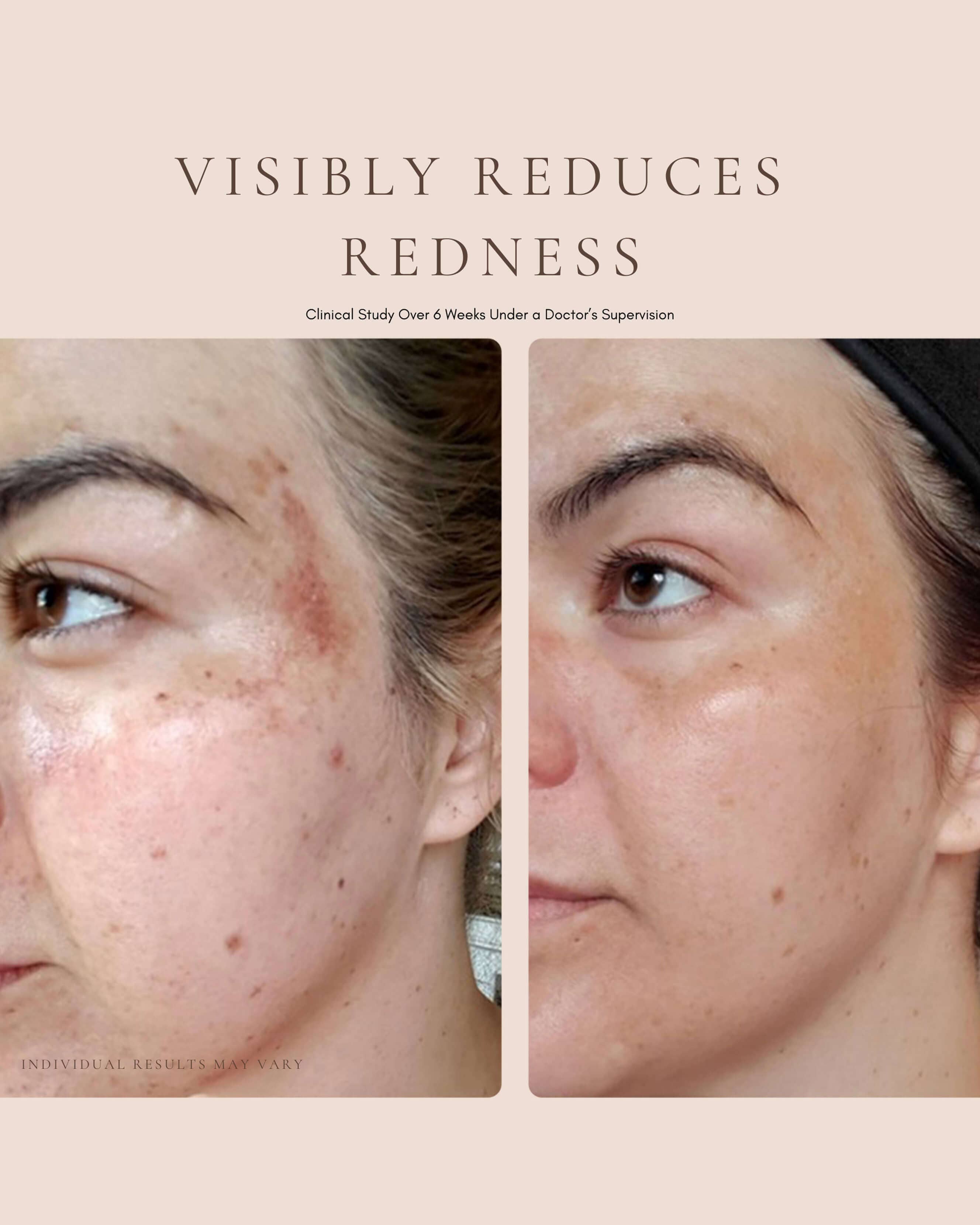 Luxury Beauty Serum