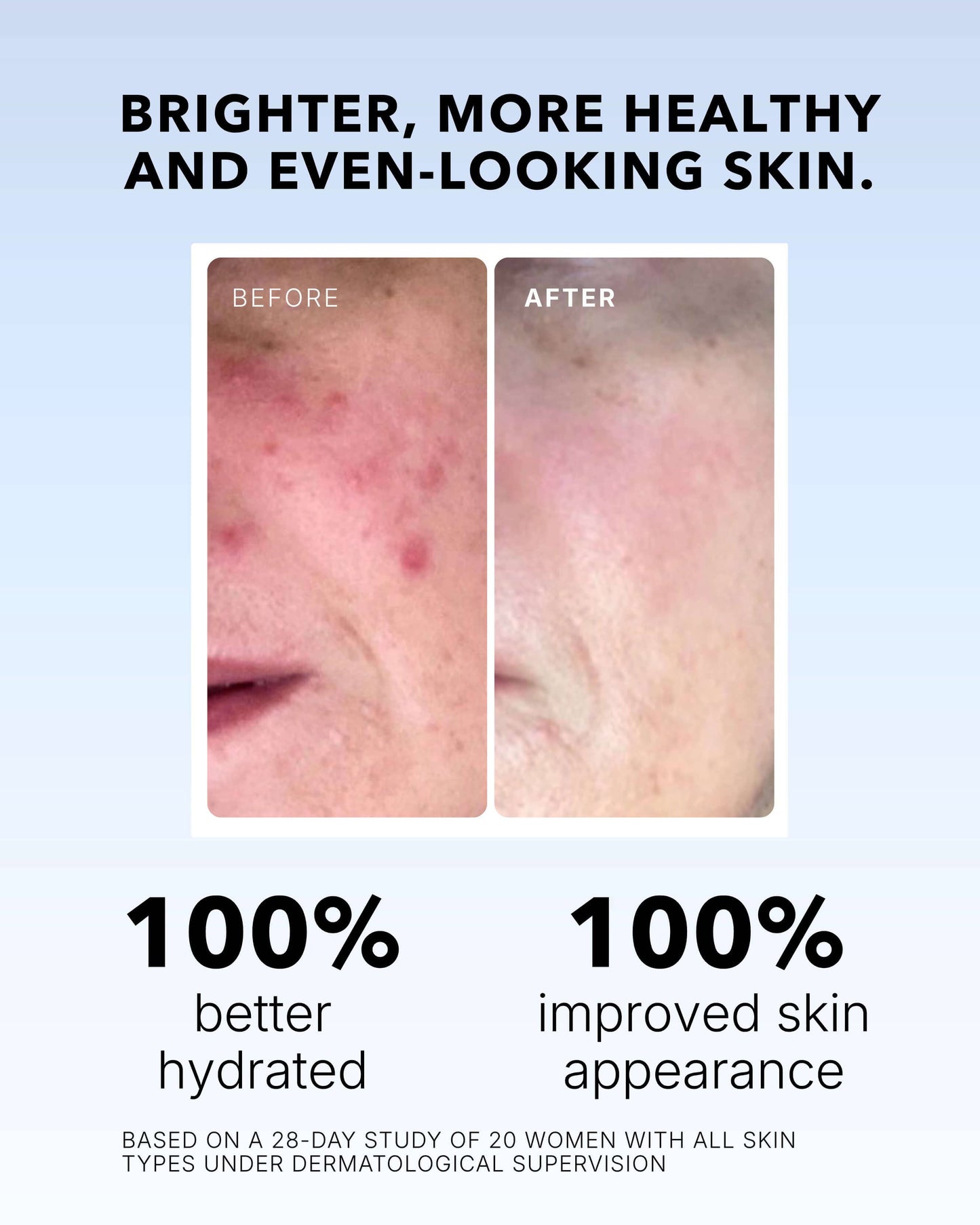 Vitamin C Serum In Oil