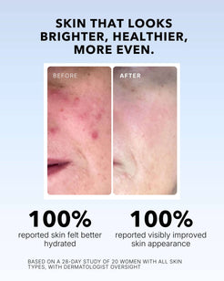 Vitamin C Serum In Oil
