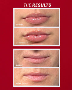 Sun Kiss (Red)