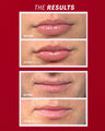 Sun Kiss (Red)
