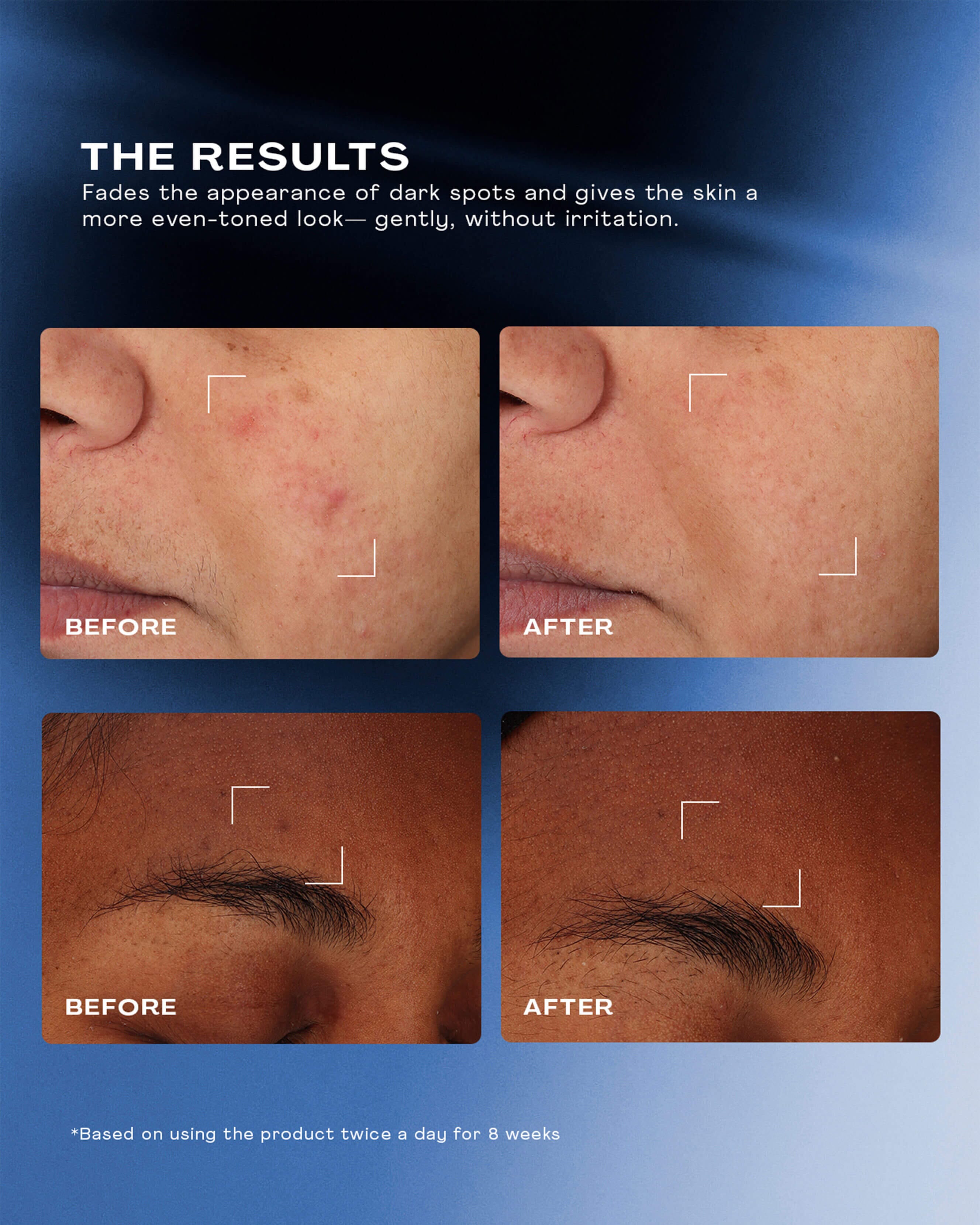 Total Clarity Dark Spot Serum