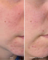 Take Control Salicylic + 10% Azelaic Acid Clarifying Serum