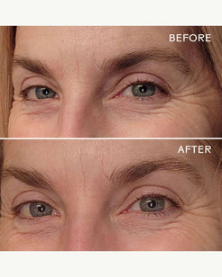 EyeHero™ Bio-Retinol Smoothing Eye Cream