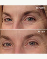 EyeHero™ Bio-Retinol Smoothing Eye Cream