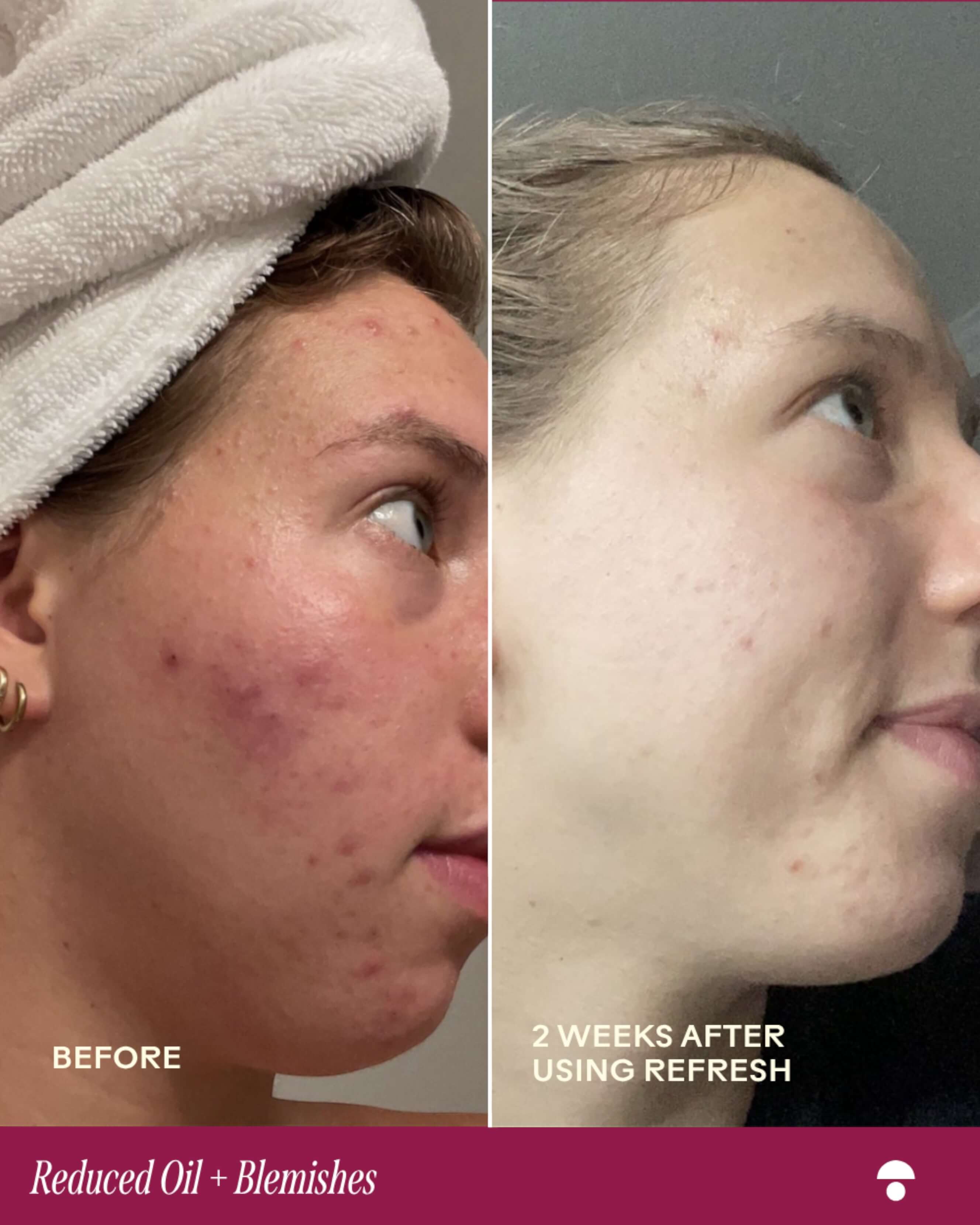 Refresh Papaya + Salicylic Acid Foaming Cleanser