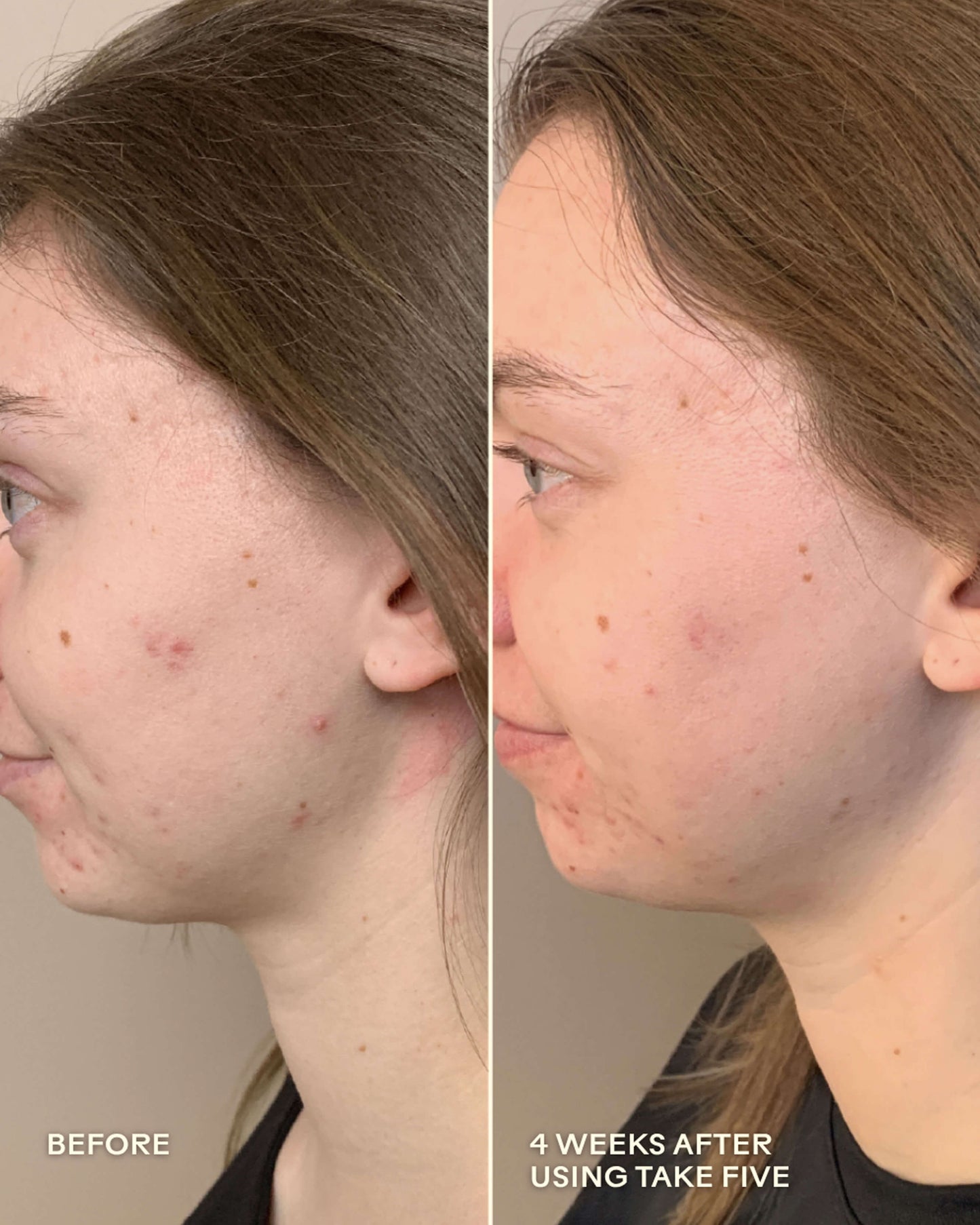 Take Five Hypochlorous Acid Balancing Body + Face Spray