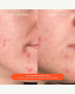 SOS Daily Barrier Recovery Cream