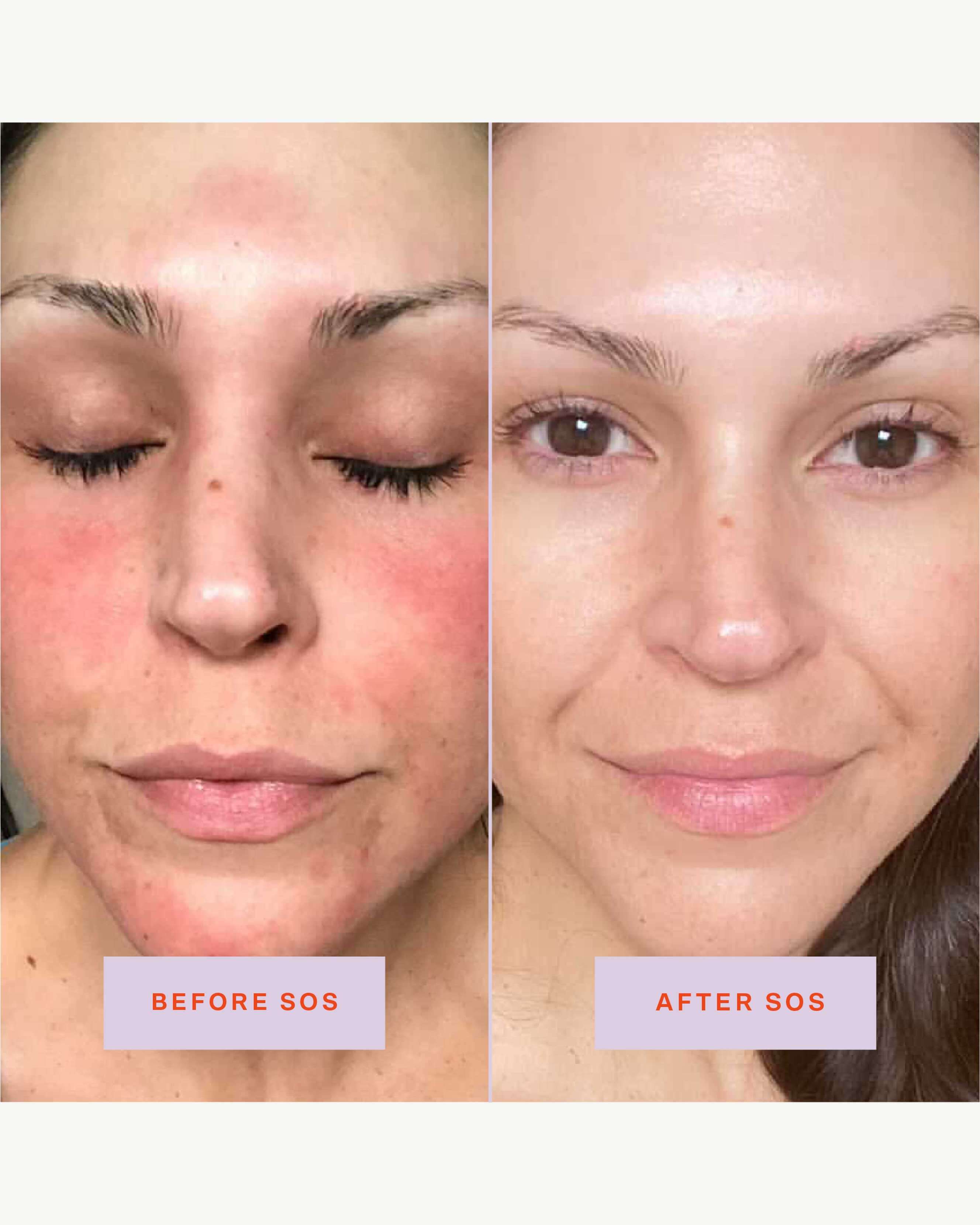 SOS (Save. Our. Skin) Daily Rescue Facial Spray