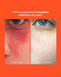 SOS Intensive Rescue Serum