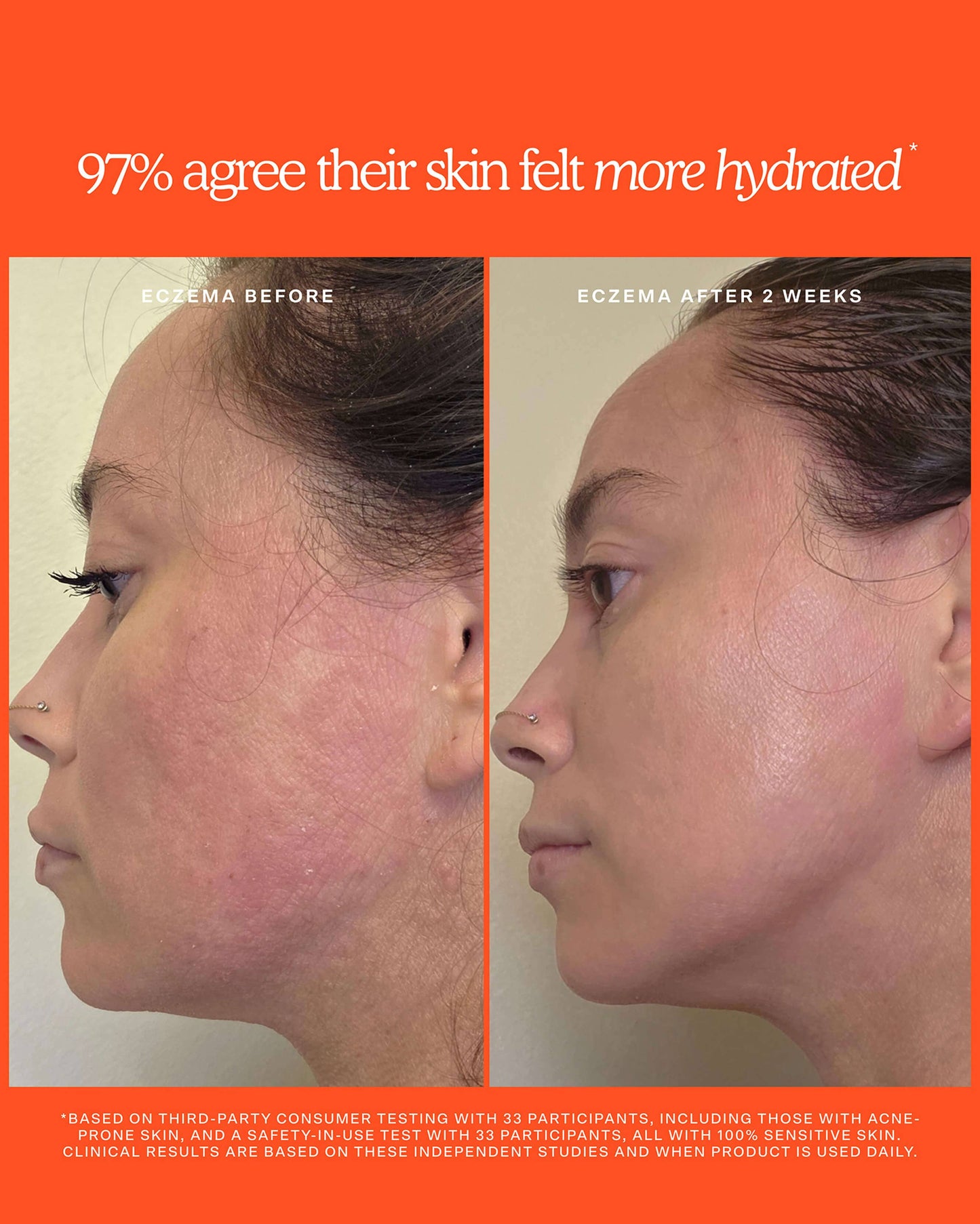 SOS Rescue + Relief Body Wash Treatment