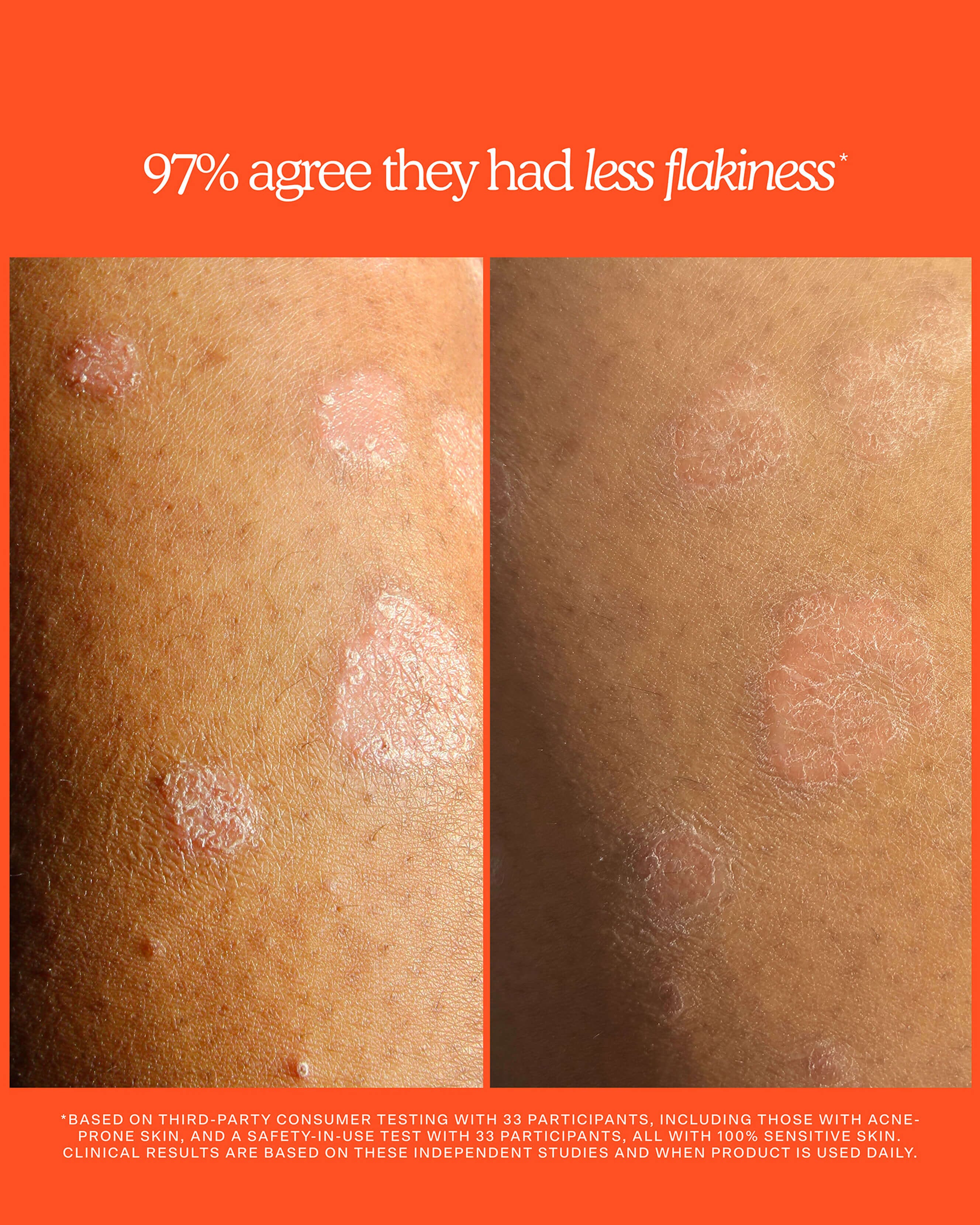 SOS Rescue + Relief Body Wash Treatment