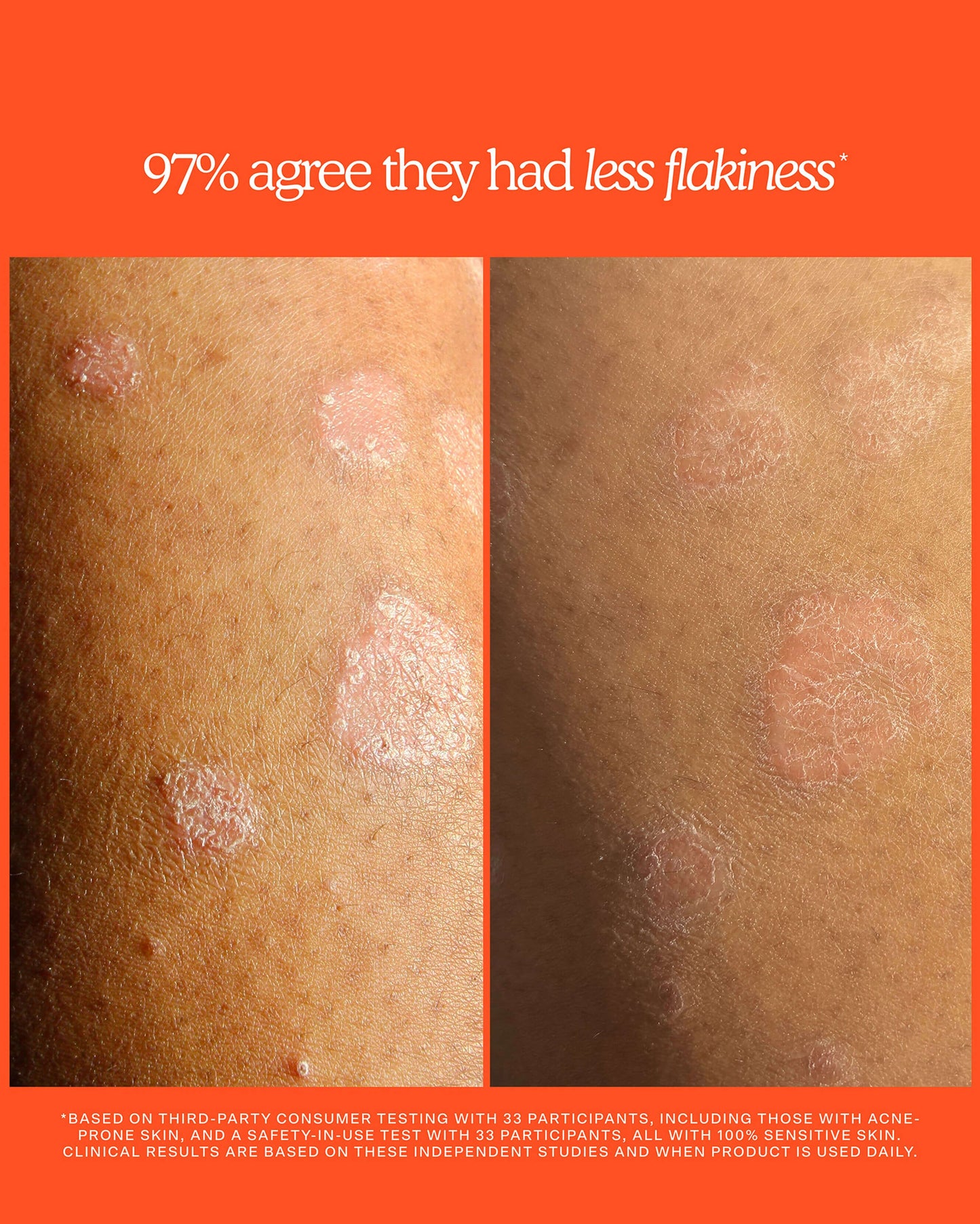 SOS Rescue + Relief Body Wash Treatment