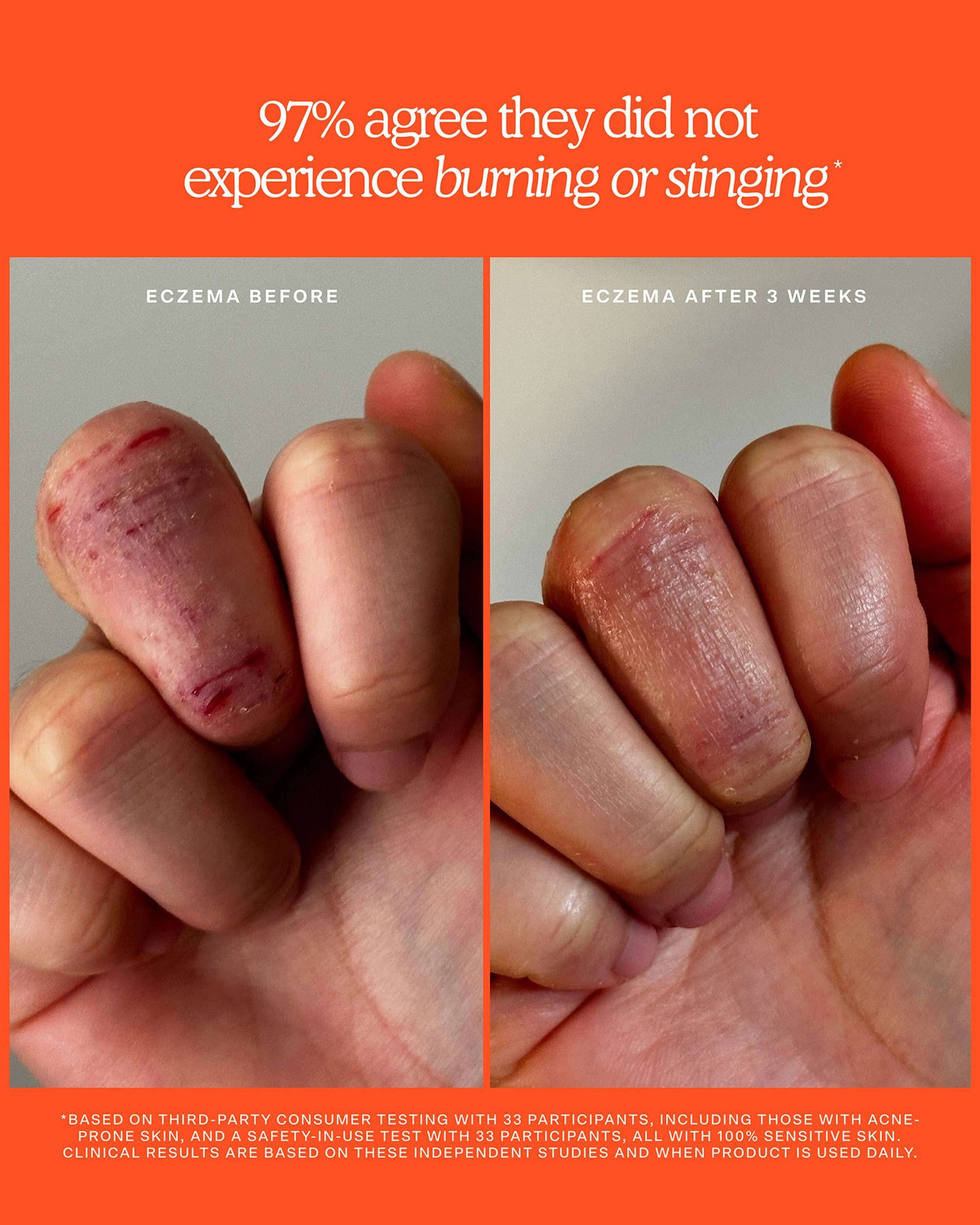 SOS Rescue + Relief Body Wash Treatment