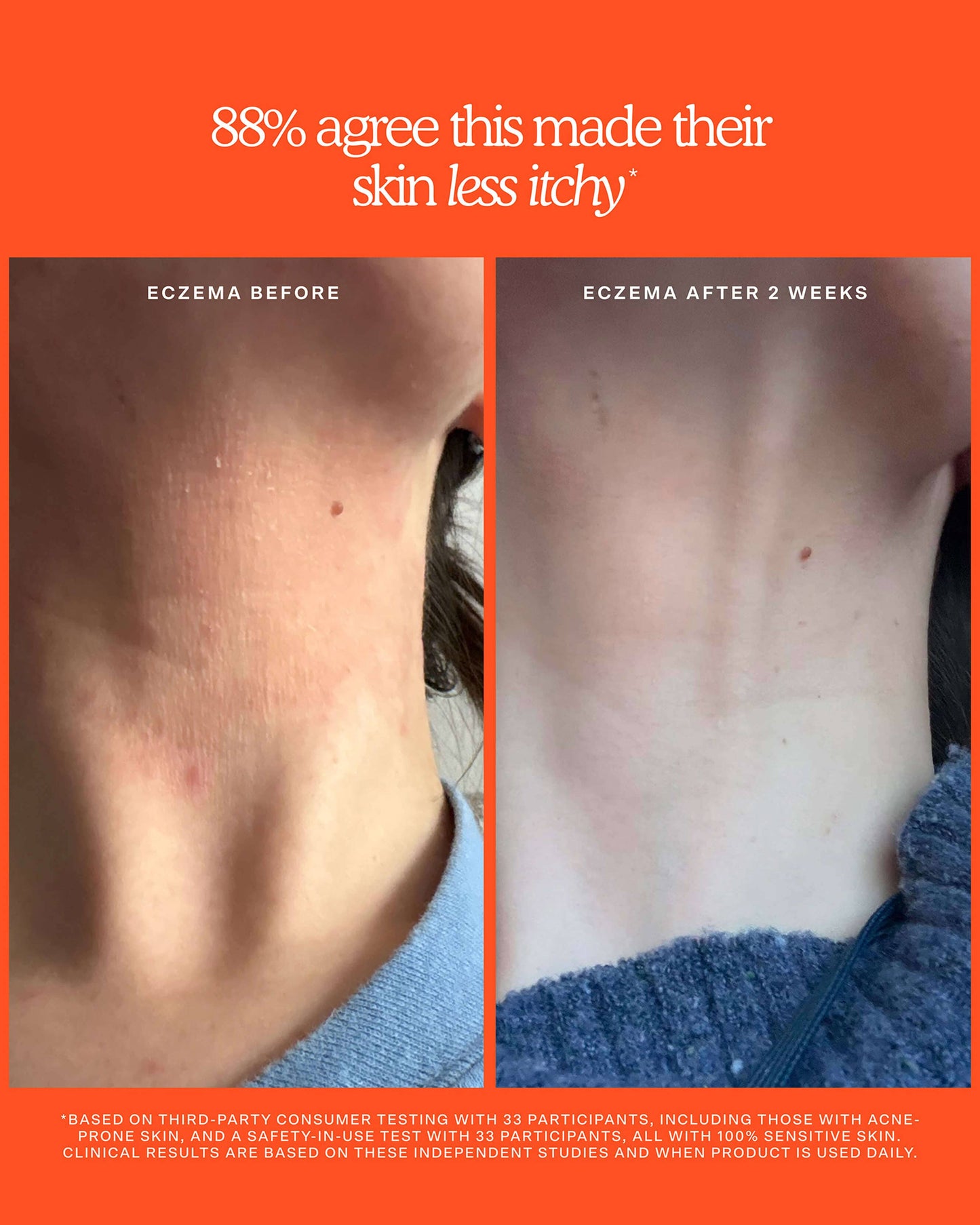 SOS Rescue + Relief Body Wash Treatment