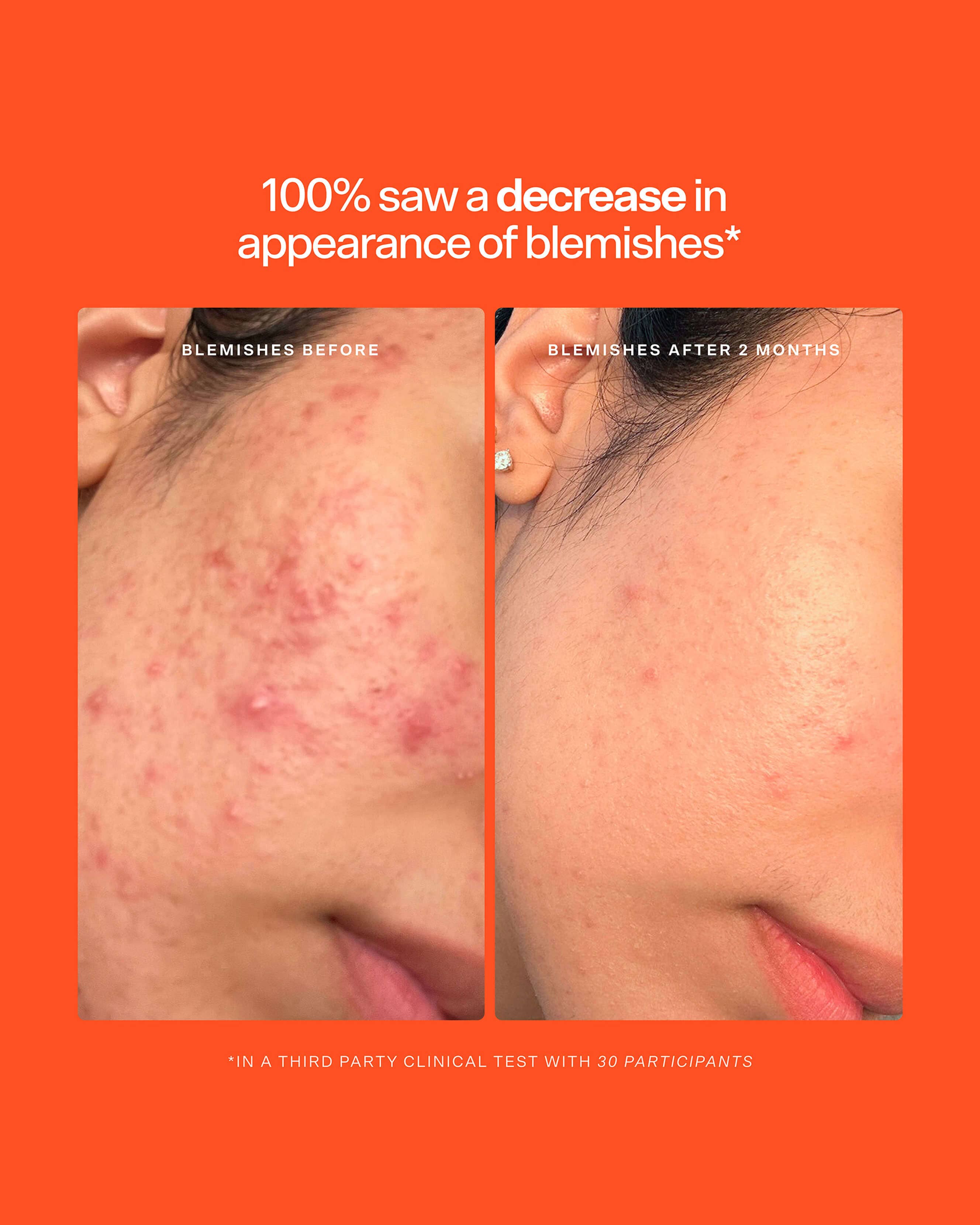 SOS Daily Rescue Spray Duo